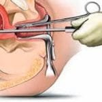 सुतेकै ठाउँमा सर्पले टोक्दा दुई बालिकाको मृत्यु, एक वृद्धा घाइते
