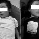 मुगुमा ५७ प्रतिशत गर्भपतन असुरक्षित