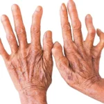 उन्नाइस वर्षमा सिक्टा सिँचाइ आयोजनाको भौतिक प्रगति ४१ प्रतिशत